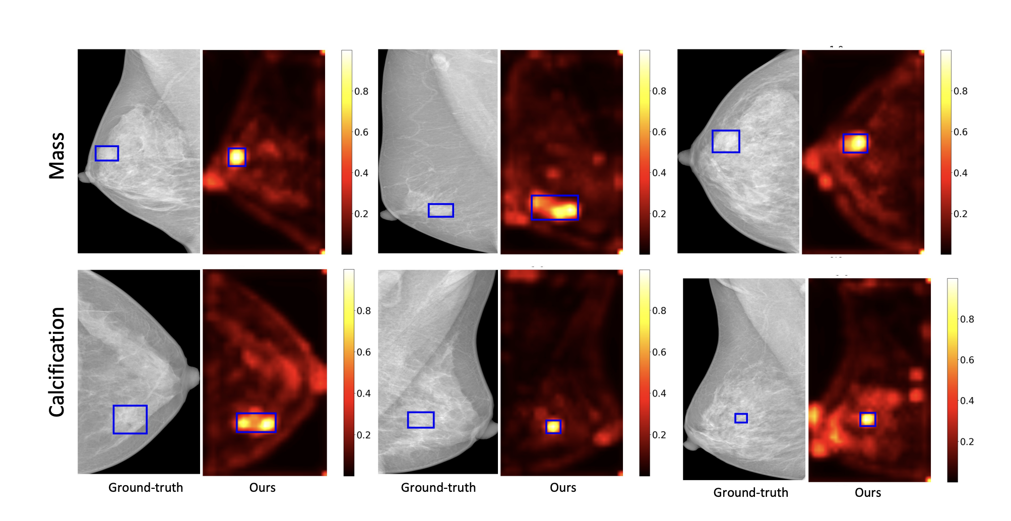 Mammo-FACtoR Interpretability